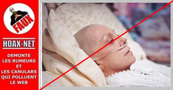 NON, la chimiothérapie ne tue pas les patients atteints du cancer