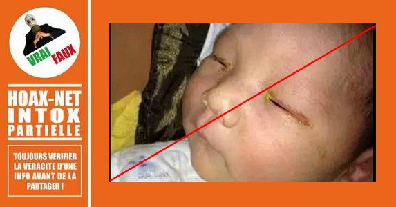 Théoriquement, il est possible qu’un bébé perde la vue à cause d’un flash.