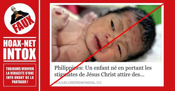 Non, ce bébé philippin ne porte pas les stigmates de Jésus Christ