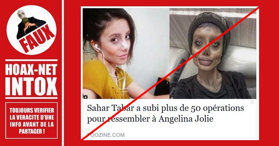 Non, Sahar Tabar n’a pas subi 50 opérations chirurgicales pour ressembler à son idole Angelina Jolie.