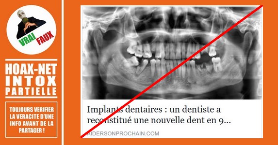 NON, un dentiste ne peut pas reconstituer une nouvelle dent en 9 semaines